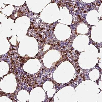 Immunohistochemistry-Paraffin: TMEFF1/Tomoregulin-1 Antibody [NBP2-13441]