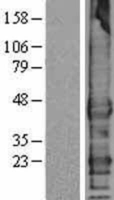 Western Blot: TMEFF1/Tomoregulin-1 Overexpression Lysate [NBL1-16987]