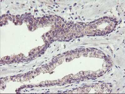 Immunohistochemistry-Paraffin: TMEFF2/Tomoregulin-2 Antibody (OTI1F9) [NBP2-01863]