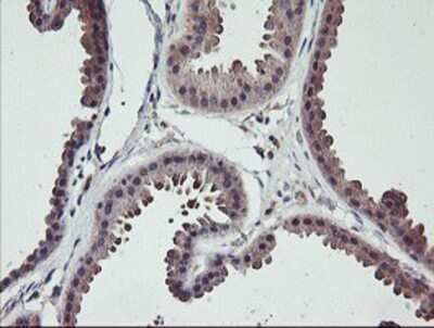 Immunohistochemistry-Paraffin: TMEFF2/Tomoregulin-2 Antibody (OTI1F9) [NBP2-01863]
