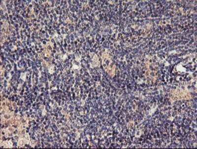 Immunohistochemistry-Paraffin: TMEFF2/Tomoregulin-2 Antibody (OTI1F9) [NBP2-01863]