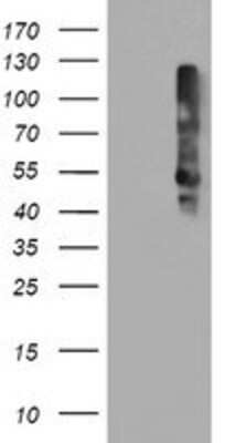 Western Blot: TMEFF2/Tomoregulin-2 Antibody (OTI1F9) [NBP2-01863]