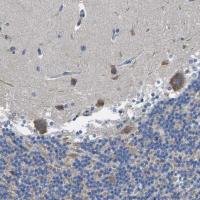 Immunohistochemistry-Paraffin: TMEFF2/Tomoregulin-2 Antibody [NBP1-84362]