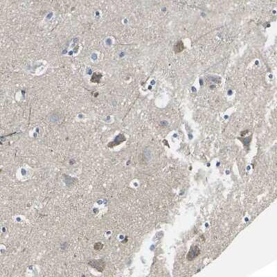 Immunohistochemistry-Paraffin: TMEFF2/Tomoregulin-2 Antibody [NBP1-84362]