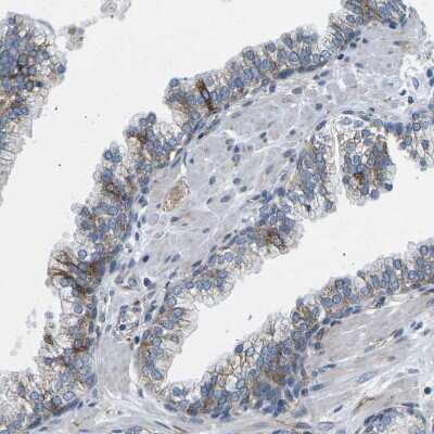 Immunohistochemistry-Paraffin: TMEFF2/Tomoregulin-2 Antibody [NBP1-84362]