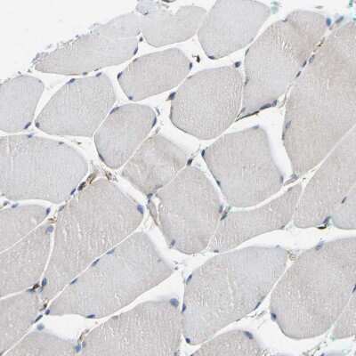 Immunohistochemistry-Paraffin: TMEFF2/Tomoregulin-2 Antibody [NBP1-84362]