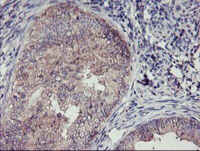 Immunohistochemistry: TMEFF2/Tomoregulin-2 Antibody (OTI1F9) - Azide and BSA Free [NBP2-74537]