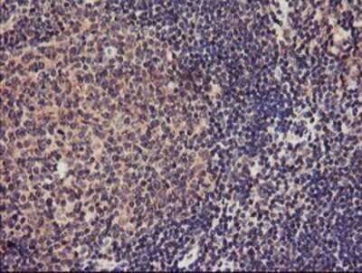 Immunohistochemistry: TMEFF2/Tomoregulin-2 Antibody (OTI1F9) - Azide and BSA Free [NBP2-74537]