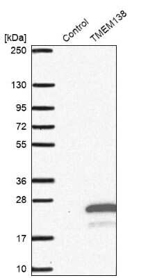 Western Blot: TMEM 138 Antibody [NBP1-92528]