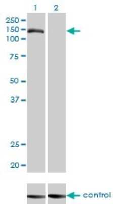 Western Blot: TMEM1 Antibody (5B4) [H00007109-M01]