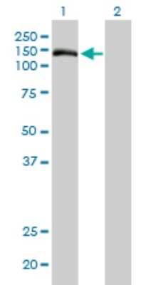 Western Blot: TMEM1 Antibody (5B4) [H00007109-M01]