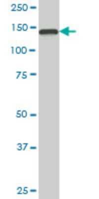 Western Blot: TMEM1 Antibody (5D5) [H00007109-M02]