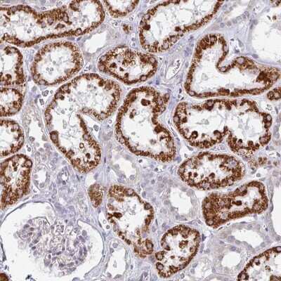 Immunohistochemistry: TMEM1 Antibody [NBP2-48963]