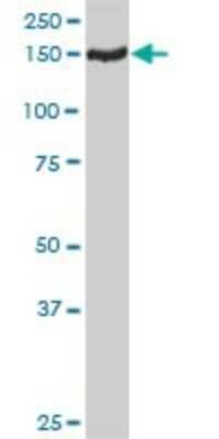 Western Blot: TMEM1 Antibody [H00007109-D01P]