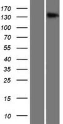 Western Blot: TMEM1 Overexpression Lysate [NBP2-10881]