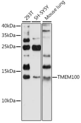 Western Blot: TMEM100 AntibodyAzide and BSA Free [NBP2-94746]