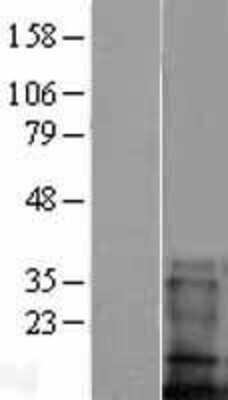 Western Blot: TMEM100 Overexpression Lysate [NBL1-16990]