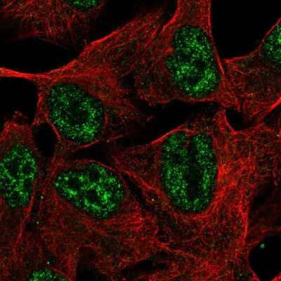 Immunocytochemistry/ Immunofluorescence: TMEM101 Antibody [NBP2-58178]