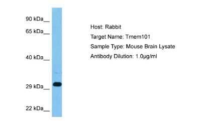 Western Blot: TMEM101 Antibody [NBP2-83664]