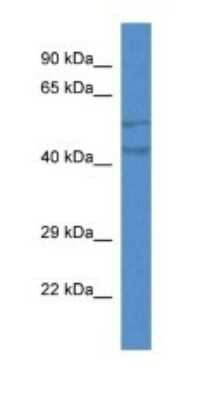 Western Blot: TMEM102 Antibody [NBP1-74231]