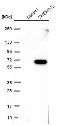 Western Blot: TMEM102 Antibody [NBP1-83484]