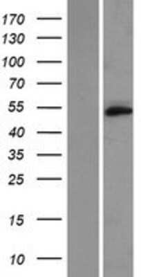 Western Blot: TMEM102 Overexpression Lysate [NBP2-04959]