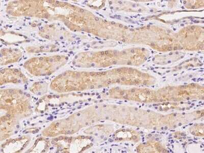 Immunohistochemistry-Paraffin: TMEM103 Antibody [NBP2-98169]