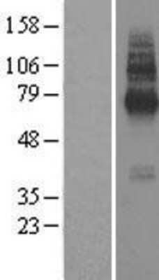 Western Blot: TMEM104 Overexpression Lysate [NBL1-16993]