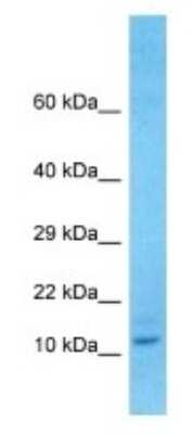 Western Blot: TMEM105 Antibody [NBP3-09895]