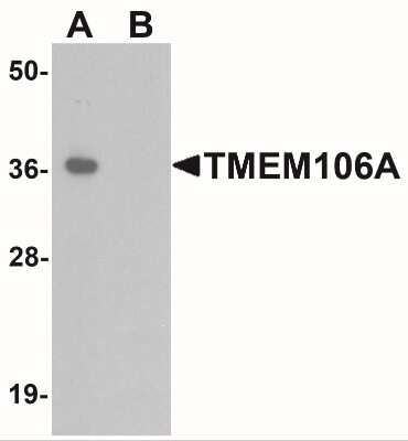 Western Blot: TMEM106A AntibodyBSA Free [NBP2-41165]