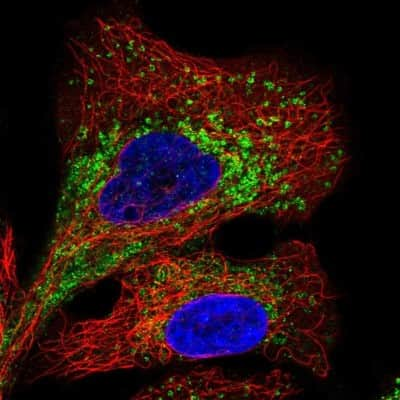 Immunocytochemistry/ Immunofluorescence: TMEM106B Antibody [NBP2-31714]