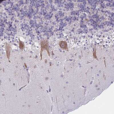 Immunohistochemistry-Paraffin: TMEM106B Antibody [NBP2-31714]