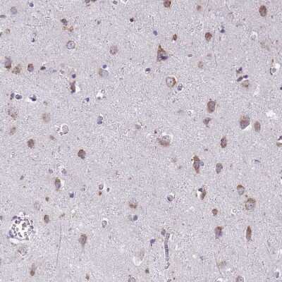 Immunohistochemistry-Paraffin: TMEM106B Antibody [NBP2-31714]