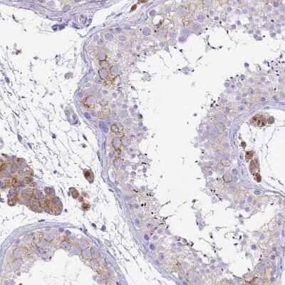 Immunohistochemistry-Paraffin: TMEM106B Antibody [NBP2-31714]