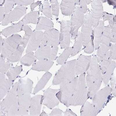 Immunohistochemistry-Paraffin: TMEM106B Antibody [NBP2-31714]