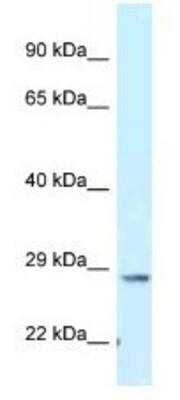 Western Blot: TMEM106B Antibody [NBP1-91311]