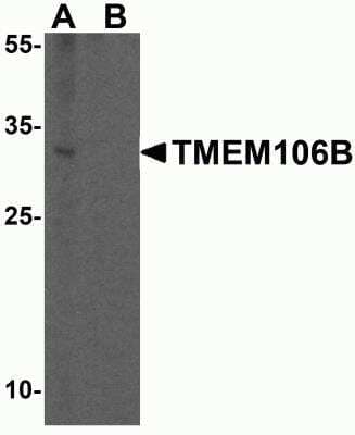 Western Blot: TMEM106B AntibodyBSA Free [NBP2-82027]