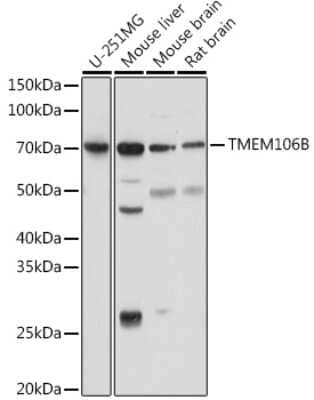 Western Blot: TMEM106B AntibodyAzide and BSA Free [NBP3-15966]