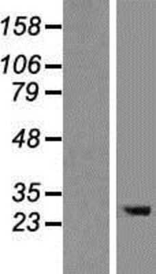 Western Blot: TMEM106B Overexpression Lysate [NBP2-09533]