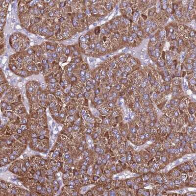Immunohistochemistry-Paraffin: TMEM106C Antibody [NBP2-13442]