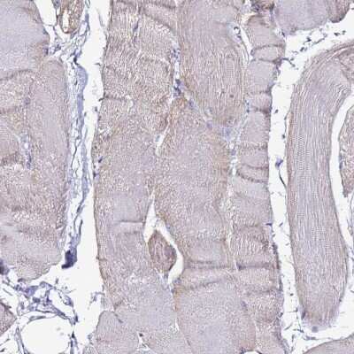 Immunohistochemistry-Paraffin: TMEM106C Antibody [NBP2-13442]