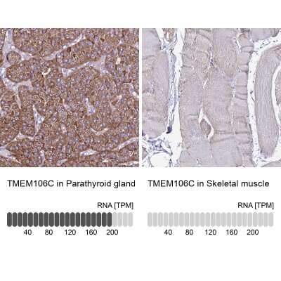 Immunohistochemistry-Paraffin: TMEM106C Antibody [NBP2-13442]