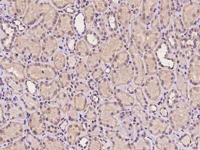 Immunohistochemistry-Paraffin: TMEM106C Antibody [NBP2-97968]