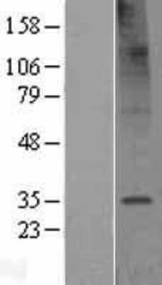 Western Blot: TMEM106C Overexpression Lysate [NBL1-16995]