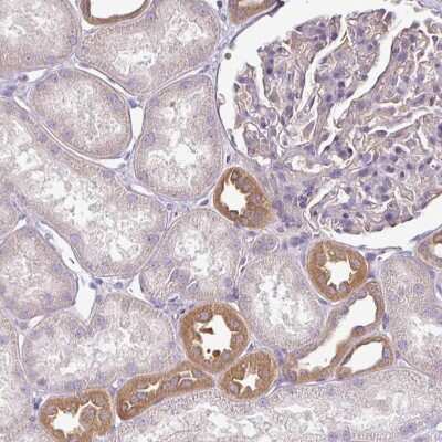 Immunohistochemistry-Paraffin: TMEM107 Antibody [NBP2-30426]