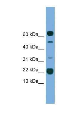 Western Blot: TMEM107 Antibody [NBP1-91359]