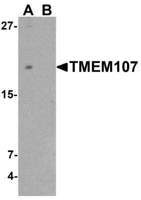 Western Blot: TMEM107 AntibodyBSA Free [NBP2-81865]