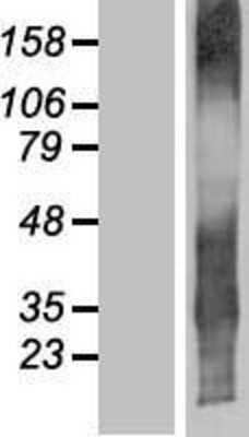 Western Blot: TMEM107 Overexpression Lysate [NBP2-04776]