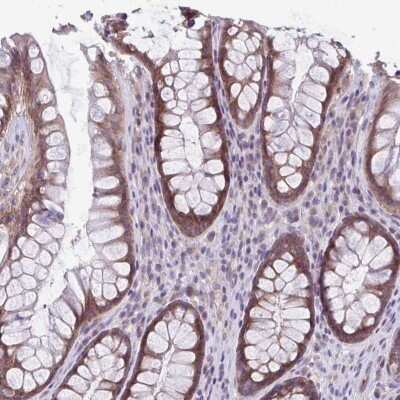 Immunohistochemistry: TMEM108 Antibody [NBP2-38991]