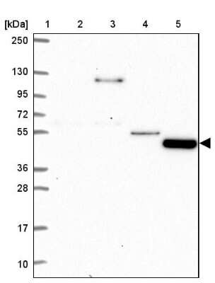 Western Blot: TMEM108 Antibody [NBP2-38991]